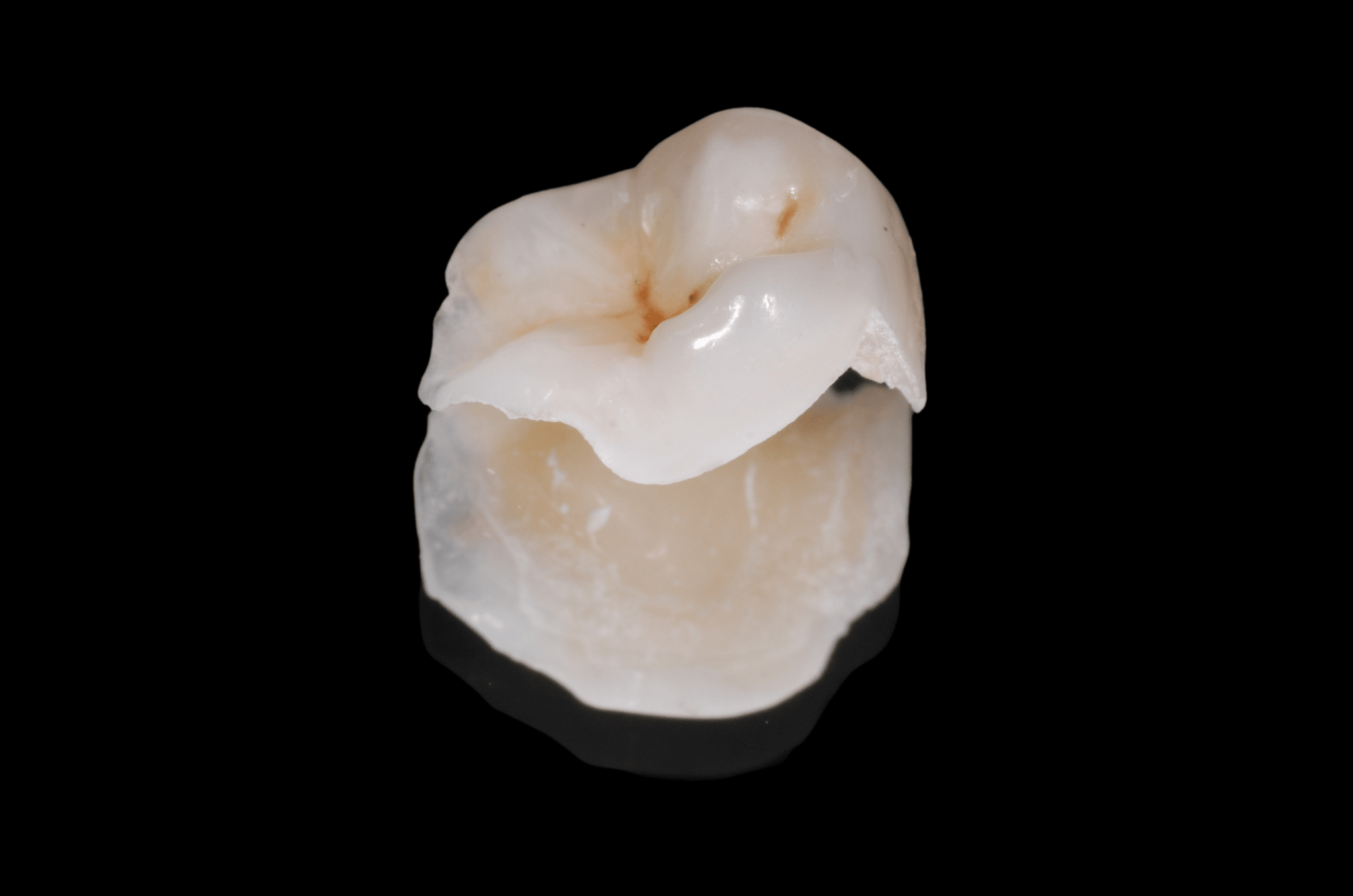 Bocca Umana Scuola Tedesca Per Esercitazioni | Didattica Odontoiatrica - Foto 9